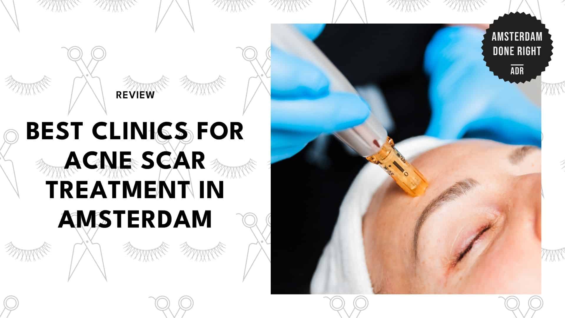 best-acne-scar-treatment-amsterdam